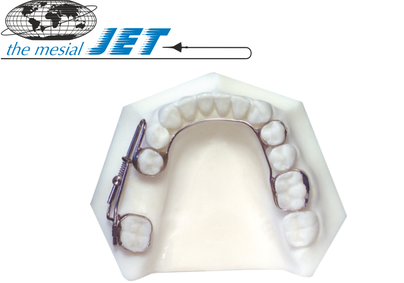 Mesial Jet