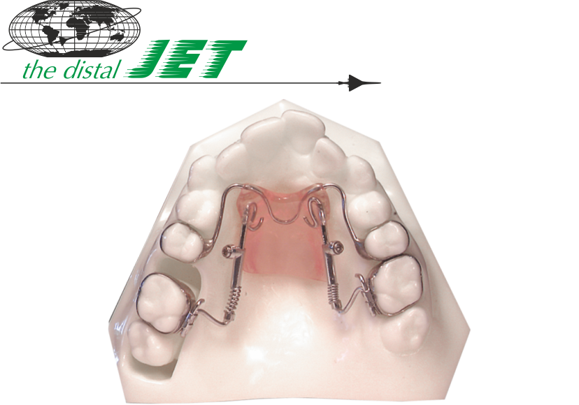 Distal Jet